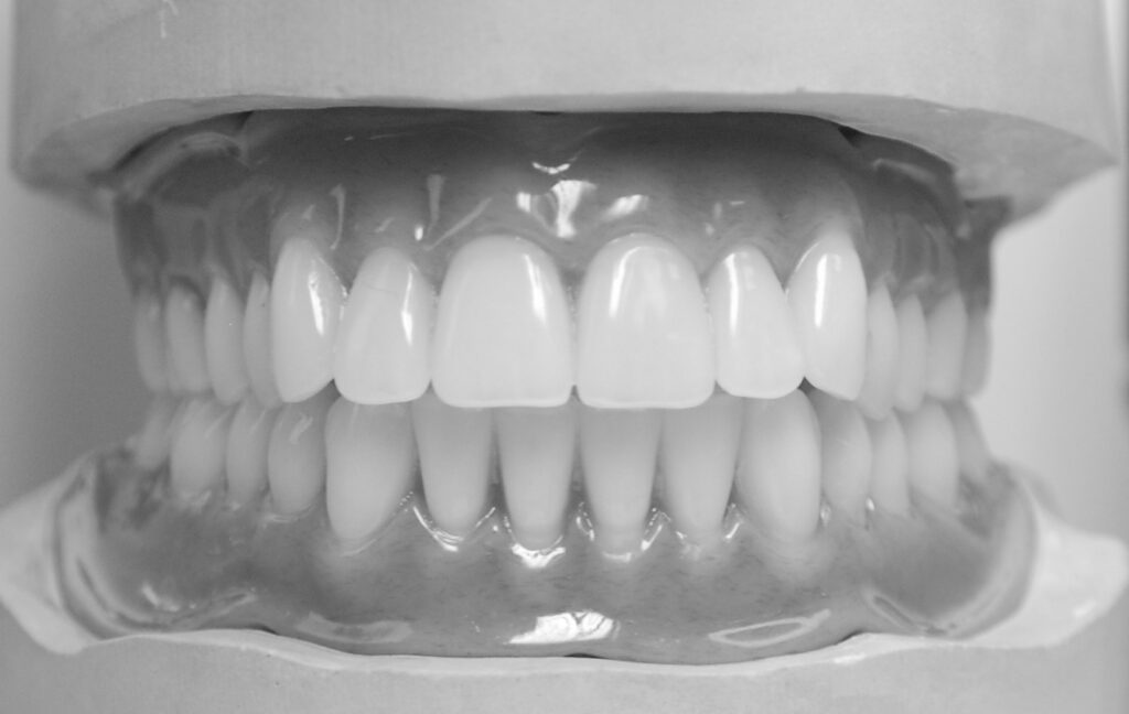 totalprothese dsf 1